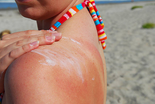 skin inflammation skin inflammation